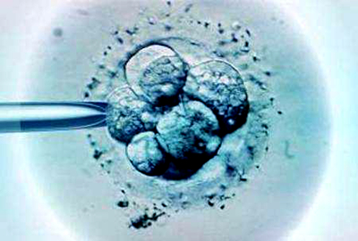 格鲁吉亚试管助孕为什么还要查DNA精子碎片？