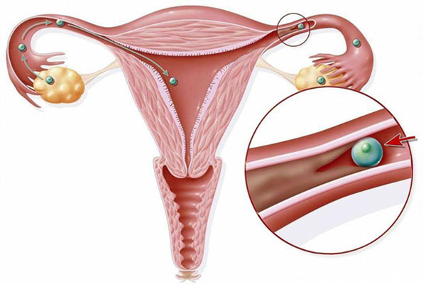 卵巢早衰的临床表现